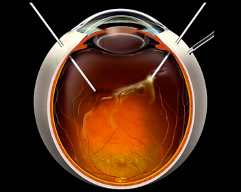 Biomicroscopia